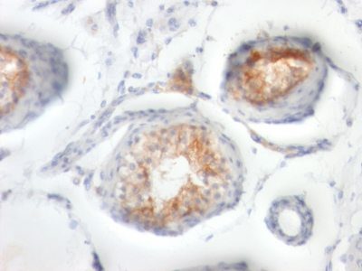 CD147 Monoclonal Mouse Antibody (BSG/963)