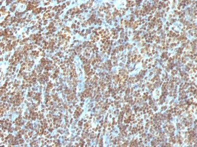 CD176 / T-F Ag Monoclonal Mouse Antibody (A68-B/A11)