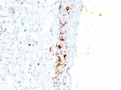 CD1a Monoclonal Mouse Antibody (C1A/711)