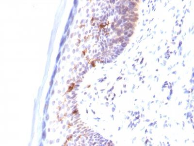 CD1a Monoclonal Mouse Antibody (C1A/711)