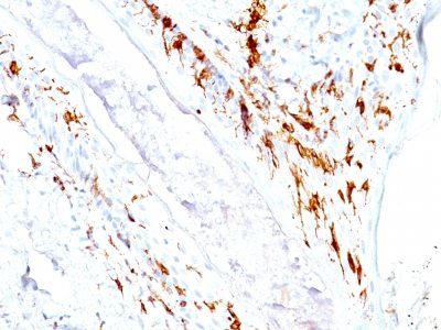 CD1a Monoclonal Mouse Antibody (O10 + C1A/711)