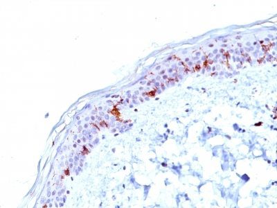 CD1a Monoclonal Mouse Antibody (O10)