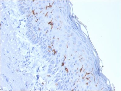 CD1a Recombinant Monoclonal Mouse Antibody (rC1A/711)