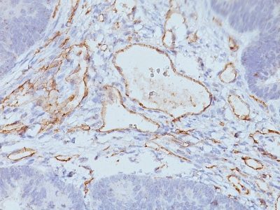 CD31 / PECAM-1 Monoclonal Mouse Antibody (158-2B3)