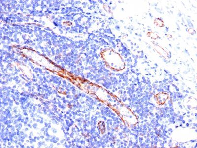 CD31 / PECAM-1 Monoclonal Mouse Antibody (C31.3)