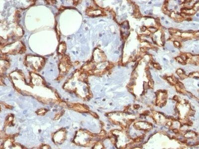 CD31 / PECAM-1 Monoclonal Mouse Antibody (C31.3)