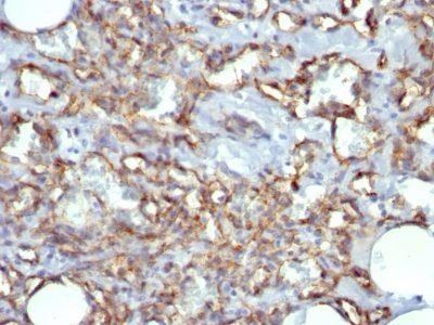 CD31 / PECAM-1 Monoclonal Mouse Antibody (JC/70A)