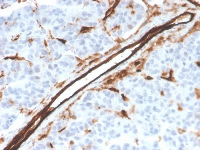 CD31 / PECAM-1 Monoclonal Mouse Antibody (PECAM1/3526)