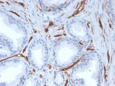 CD31 / PECAM-1 Monoclonal Mouse Antibody (PECAM1/3527)