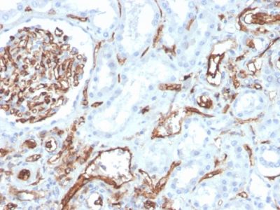 CD31 / PECAM-1 Monoclonal Mouse Antibody (PECAM1/3528)