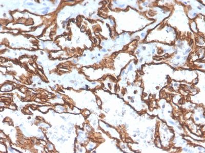 CD31 / PECAM-1 Monoclonal Mouse Antibody (PECAM1/3529)