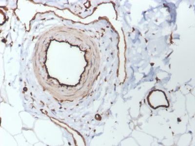 CD31 / PECAM-1 Monoclonal Mouse Antibody (PECAM1/3530)