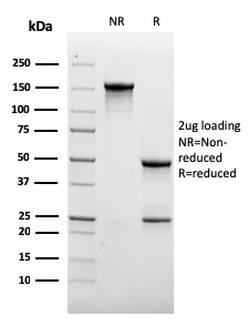 CD31 / PECAM-1 Recombinant Monoclonal Mouse Antibody (rC31.3)