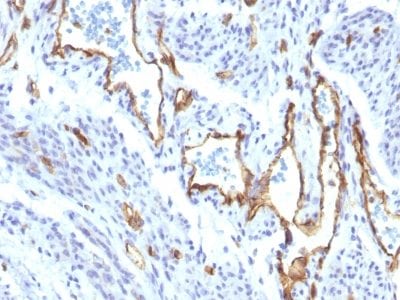 CD31 / PECAM-1 Recombinant Monoclonal Rabbit Antibody (C31/1395R)