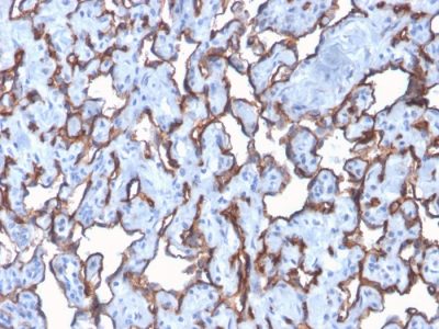 CD31 / PECAM-1 Recombinant Monoclonal Rabbit Antibody (C31/2876R)