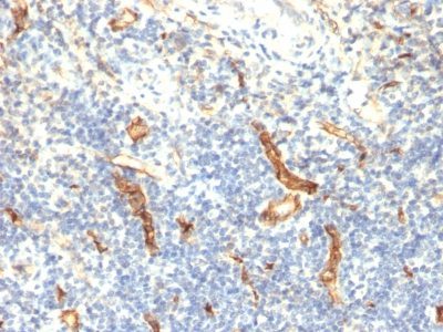 CD34 Monoclonal Mouse Antibody (HPCA1/1171)