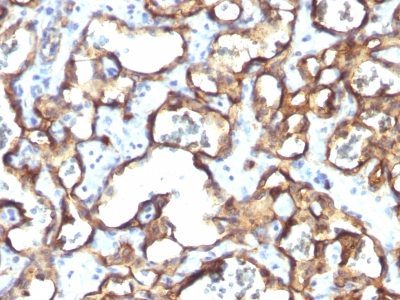 CD34 Monoclonal Mouse Antibody (HPCA1/1171)
