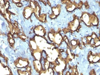 CD34 Monoclonal Mouse Antibody (QBEnd/10 + HPCA1/763)