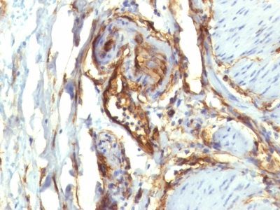 CD34 Monoclonal Mouse Antibody (QBEnd/10 + HPCA1/763)