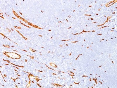 CD34 Monoclonal Mouse Antibody (QBEnd/10)