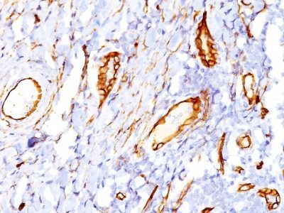 CD34 Monoclonal Mouse Antibody (QBEnd/10)