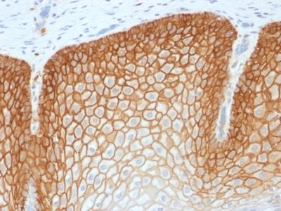 CD44v4 Recombinant Monoclonal Rabbit Antibody (CD44v4/1700R)