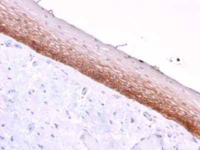 CD44v4/5 Monoclonal Mouse Antibody (3D2)