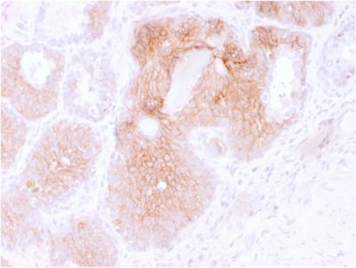 CD44v6 Monoclonal Mouse Antibody (CD44V6/2496)