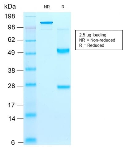 CD44v9 Recombinant Monoclonal Mouse Antibody (rCD44v9/1459)
