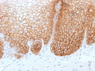 CD44v9 Recombinant Monoclonal Mouse Antibody (rCD44v9/1459)
