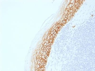 CD44v9 Recombinant Monoclonal Rabbit Antibody (CD44v9/2344R)