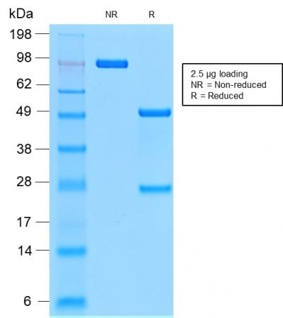 CD44v9 Recombinant Monoclonal Rabbit Antibody (CD44v9/2344R)