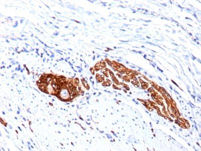CD56 / NCAM Monoclonal Mouse Antibody (123C3.D5 + 123A8)