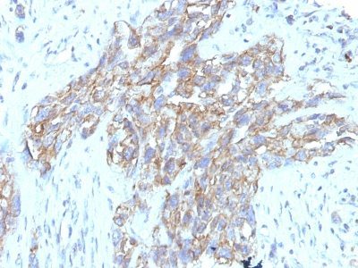 CD56 / NCAM Monoclonal Mouse Antibody (123C3.D5 + 123A8)