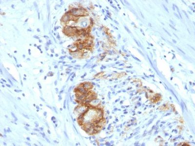 CD56 / NCAM Monoclonal Mouse Antibody (123C3.D5)