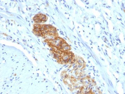 CD56 / NCAM Monoclonal Mouse Antibody (NCAM1/784)