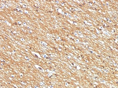 CD56 / NCAM Monoclonal Mouse Antibody (NCAM1/795)