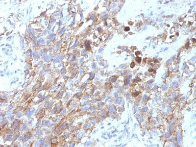 CD56 / NCAM Monoclonal Mouse Antibody (NCAM1/795)