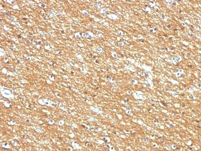 CD56 / NCAM Monoclonal Mouse Antibody ) (123A8, same as 56C04)