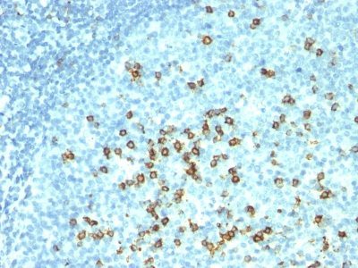CD57 / B3GAT1 Monoclonal Mouse Antibody (NK-1 + HNK-1)