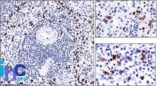 CD57 / B3GAT1 Monoclonal Mouse Antibody (NK-1)