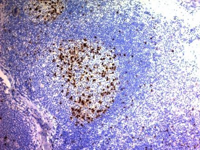 CD57 / B3GAT1 Monoclonal Mouse Antibody (NK/804)