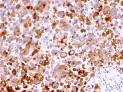 CD63 Monoclonal Mouse Antibody (LAMP3/2788)