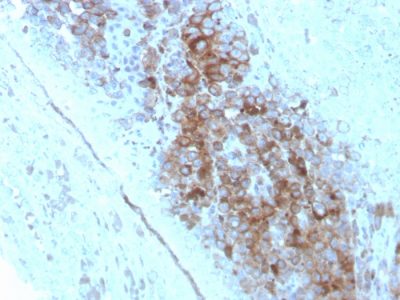 CD63 Monoclonal Mouse Antibody (LAMP3/2789)