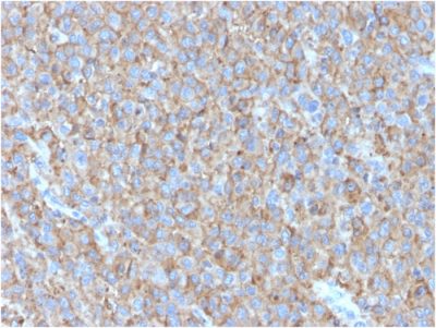 CD63 Monoclonal Mouse Antibody (LAMP3/2790)