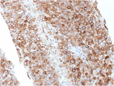 CD63 Monoclonal Mouse Antibody (LAMP3/2881)