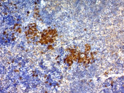 CD63 Monoclonal Mouse Antibody (NKI-C3)