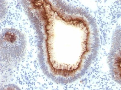 CD66 / CEA Monoclonal Mouse Antibody (C66/1009)
