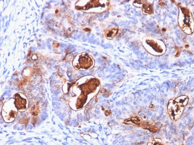 CD66 / CEA Monoclonal Mouse Antibody (C66/1260)