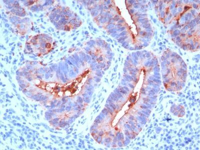 CD66 / CEA Monoclonal Mouse Antibody (C66/195)